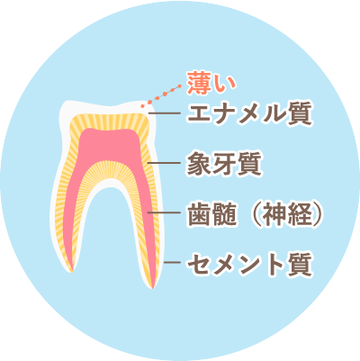 乳歯のむし歯の特徴