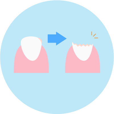 乳歯のむし歯の特徴