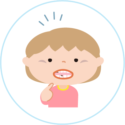 乳歯のむし歯による影響